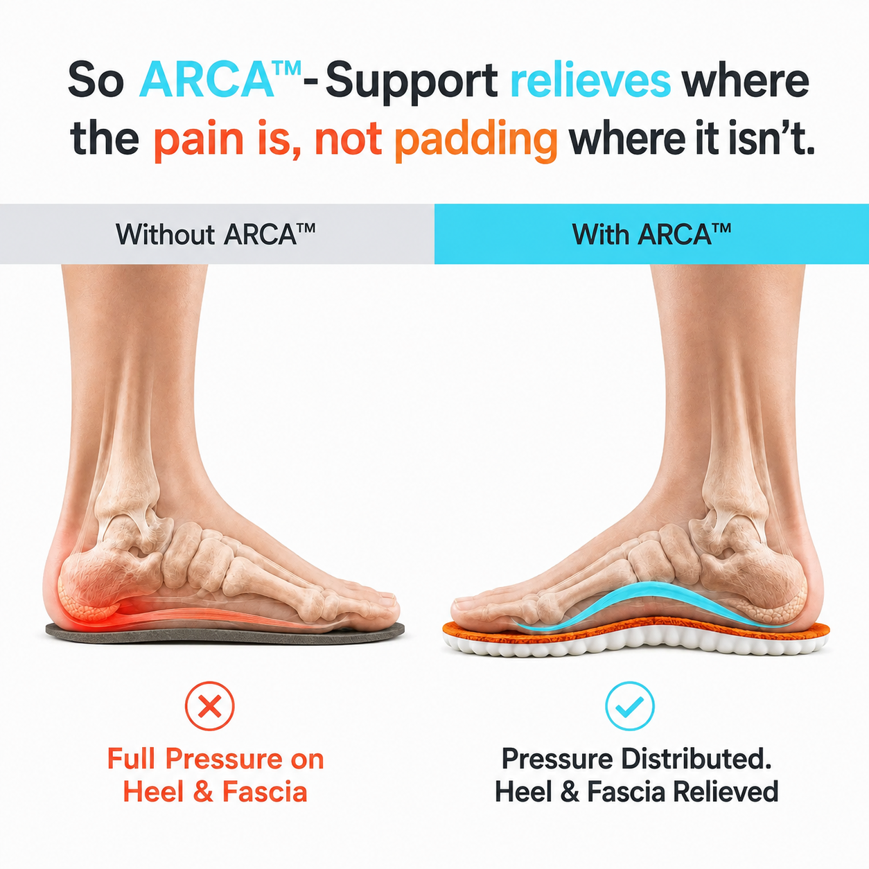 ARCA™- Support where the pain is, not padding where it isn't